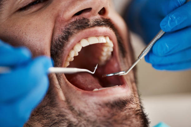 Best Urgent Care for Lost Fillings or Crowns in Hamlin, TX