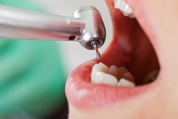 Best Urgent Care for Lost Fillings or Crowns in Hamlin, TX